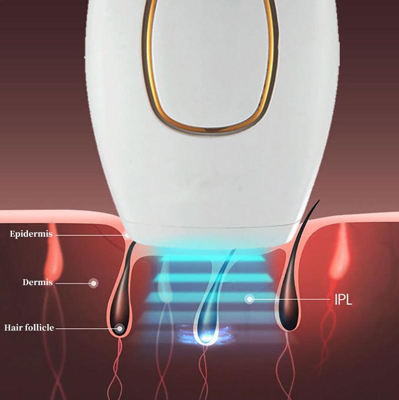 Depilador a Laser Definitivo Importado/LaserDepil - Abba Shop